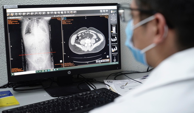 Impulsa IMSS Veracruz Sur prevención y detección oportuna de EPOC Impulsa IMSS Veracruz Sur prevención y detección oportuna de EPOC