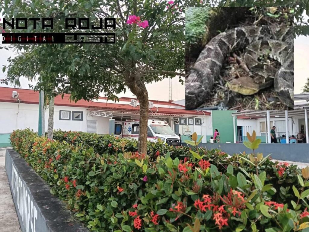 Emergencia por mordedura de víbora exhibe falta de suero en hospital de Las Choapas Emergencia por mordedura de víbora exhibe falta de suero en hospital de Las Choapas