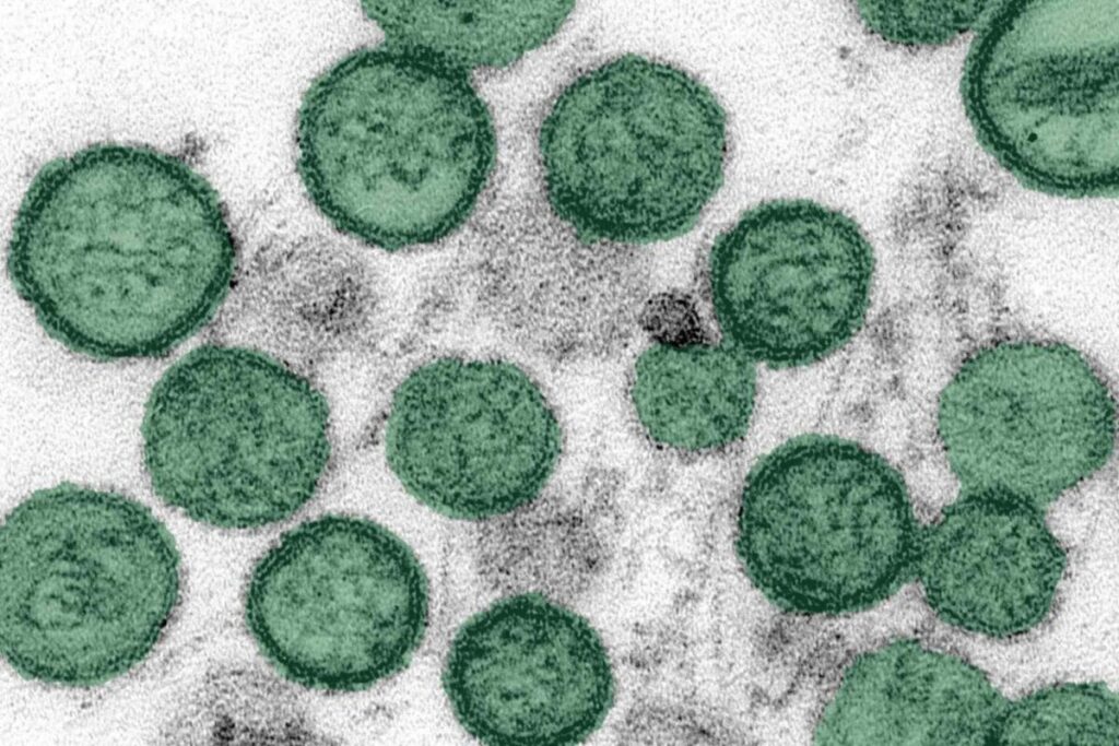 ¿Brote de hantavirus en un crucero puede convertirse en una epidemia? OMS responde ¿Brote de hantavirus en un crucero puede convertirse en una epidemia? OMS responde