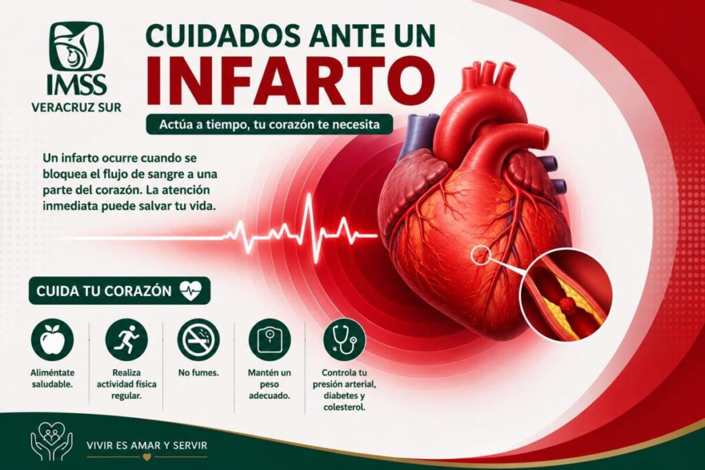 Informa IMSS Veracruz Sur sobre cómo detectar síntomas ante un infarto